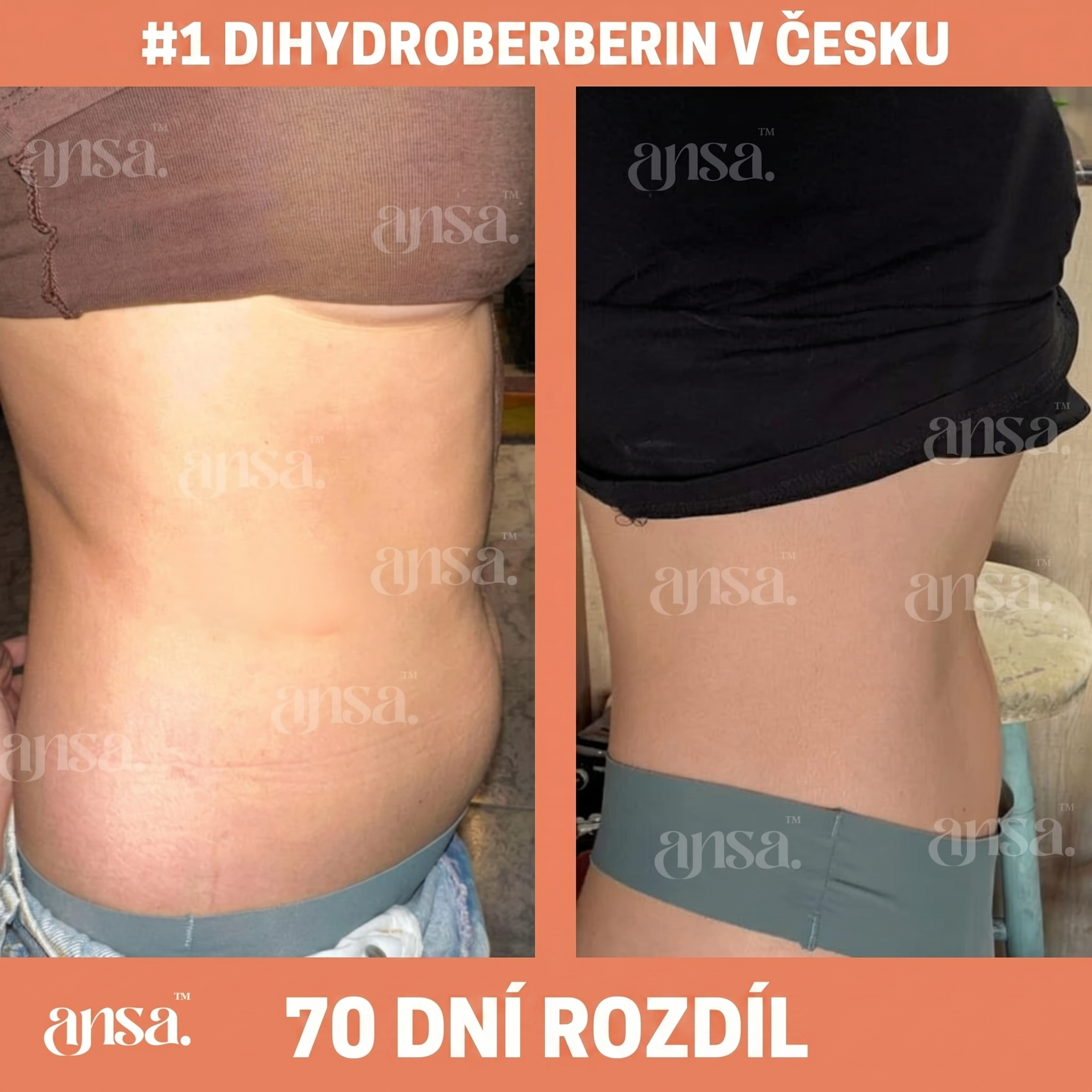 #1 Dihydroberberin v Česku – 70denní rozdíl