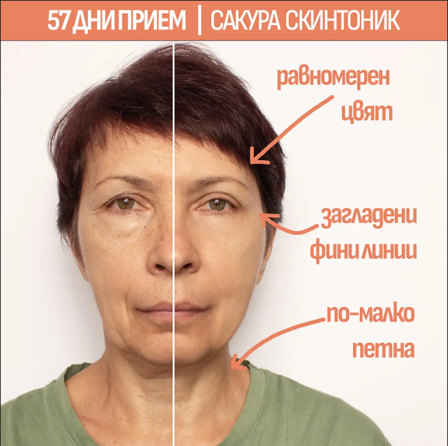 57 дни прием - Sakura SkinTonic резултат